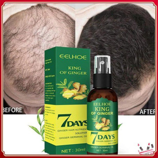 7 Dias de Eelhoe King Of Ginger Spray de Crescimento Capilar Prevenção da Queda de Cabelo Promove o Crescimento Capilar em Oferta na Shopee