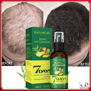 7 Dias de Eelhoe King Of Ginger Spray de Crescimento Capilar Prevenção da Queda de Cabelo Promove o Crescimento Capilar