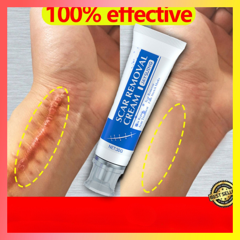 gel De Remoção De Cicatrizes Para Pernas Antigas Marcas Originais Creme De acne Desaparece Novas Queimaduras E Sem