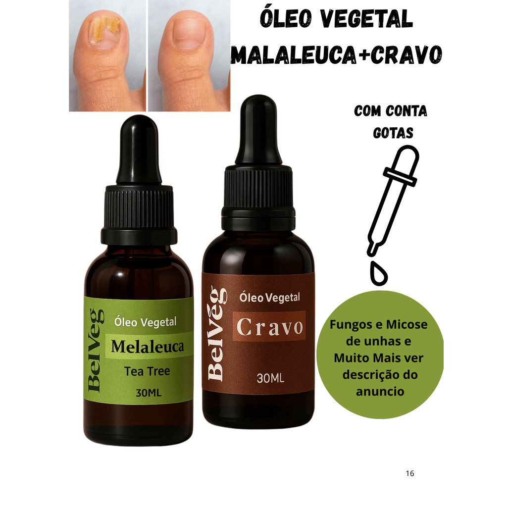 Kit óleo Malaleuca + Cravo 30ml Cada - Fungos e Micose de unhas e Muito Mais