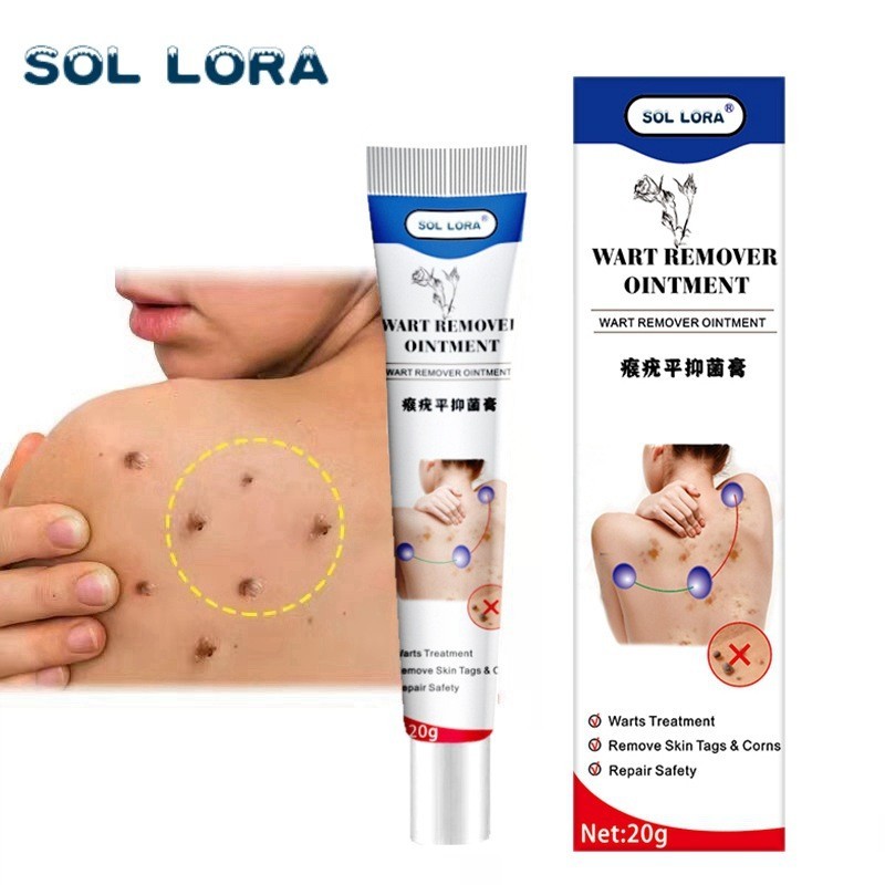Detalhes do Qu Yu Gao Huang Ping Pomada Para Verrugas De Seda Manchas De Olhos De Frango