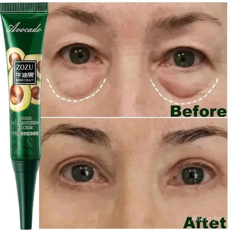 Creme para remoção instantânea de rugas, reduz olheiras, minimiza inchaço, atenua linhas finas ao redor dos olhos e toni