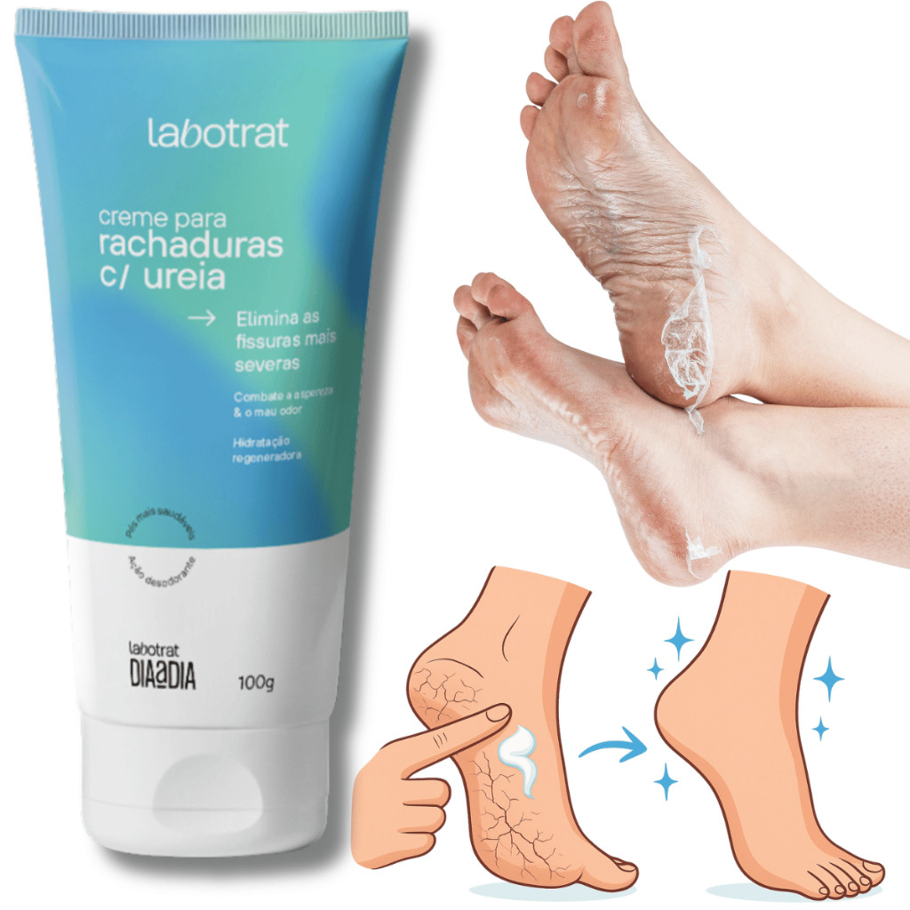 Creme Rachaduras calos hidratante ureia pé de pedreiro calcanhar aspero seco chulé