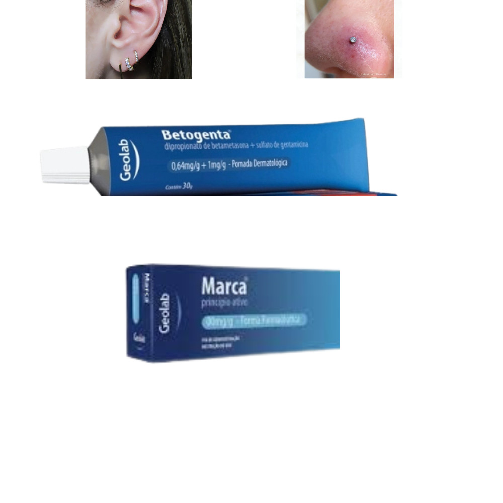 Betogen Pomada para Queloid de Piercing 30g em Oferta na Shopee