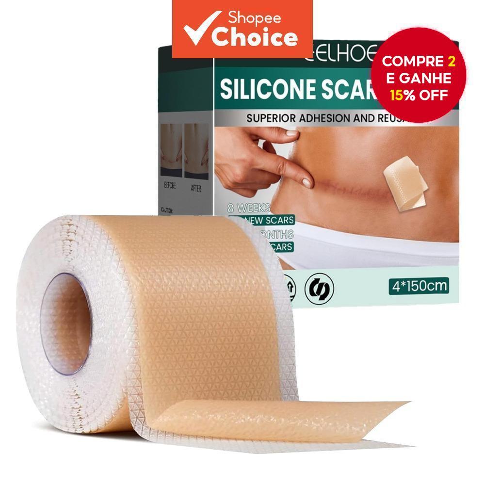 Folha De Cicatriz De Silicone - Patches Adesivos Para Reparação De Cicatrizes, Acne, Trauma E Queimaduras - 4*150cm