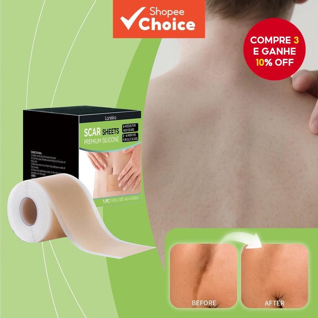 Tira De Remoção De Queloide De Silicone , Folha De Fitas De Cuidados Com A Pele , Conforto Cirúrgico Compacto Para Cicat Tira De Remoção De Queloide De Silicone , Folha De Fitas De Cuidados Com A Pele , Conforto Cirúrgico Compacto Para Cicat