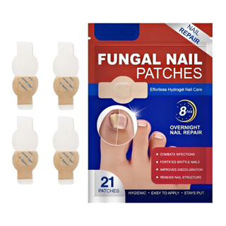 Adesivo para Tratamento de Fungos nas Unhas - Patch de Reparação Noturna (21/32 Unidades) em Oferta na Shopee