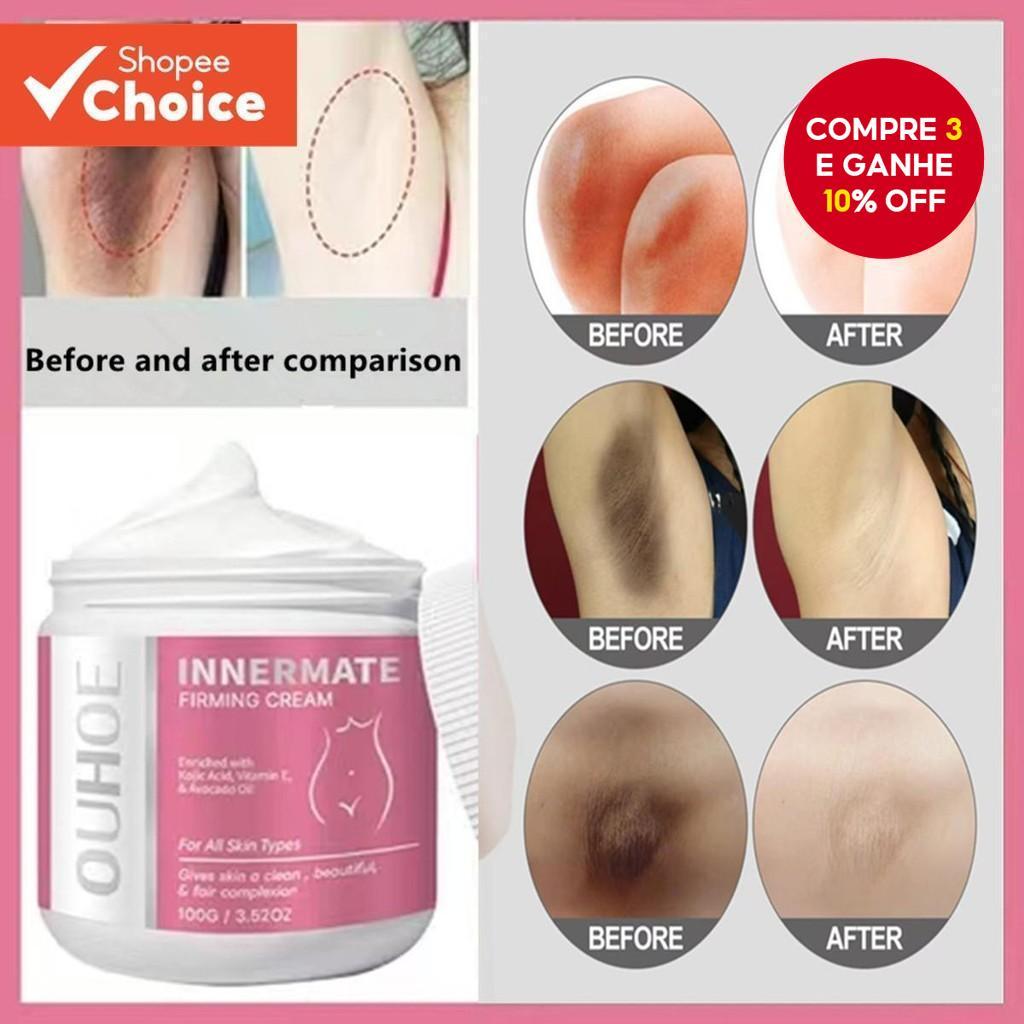 Creme Clareador Para Axilas , Íntimo Partes Íntimas Escuras , Joelhos , Coxa , Articulação Interna , Biquíni , Remoção D em Oferta na Shopee