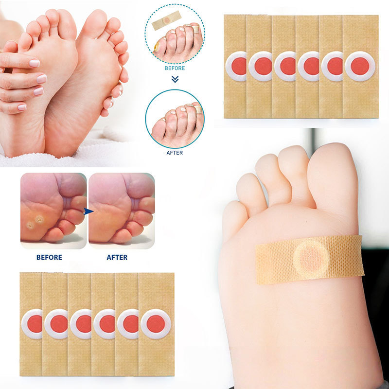 [Envio em 24 horas] 5/40 Adesivos Removedor De Calos Do Pé Olhos De Peixe - Cuidados com os pés
