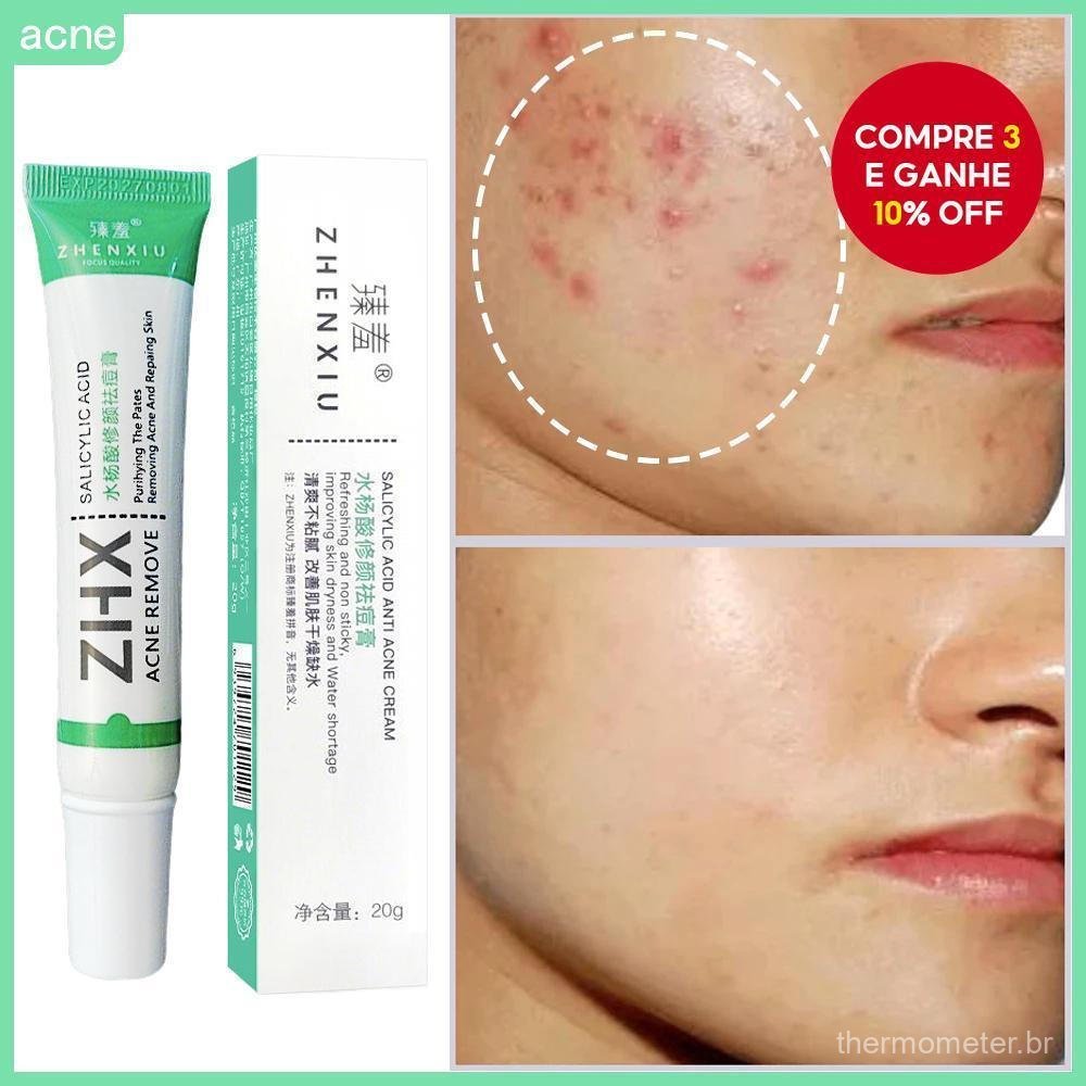 Contém creme para acne com ácido salicílico, usado para remover oleosidade e cravos e reduzir marcas de acne.