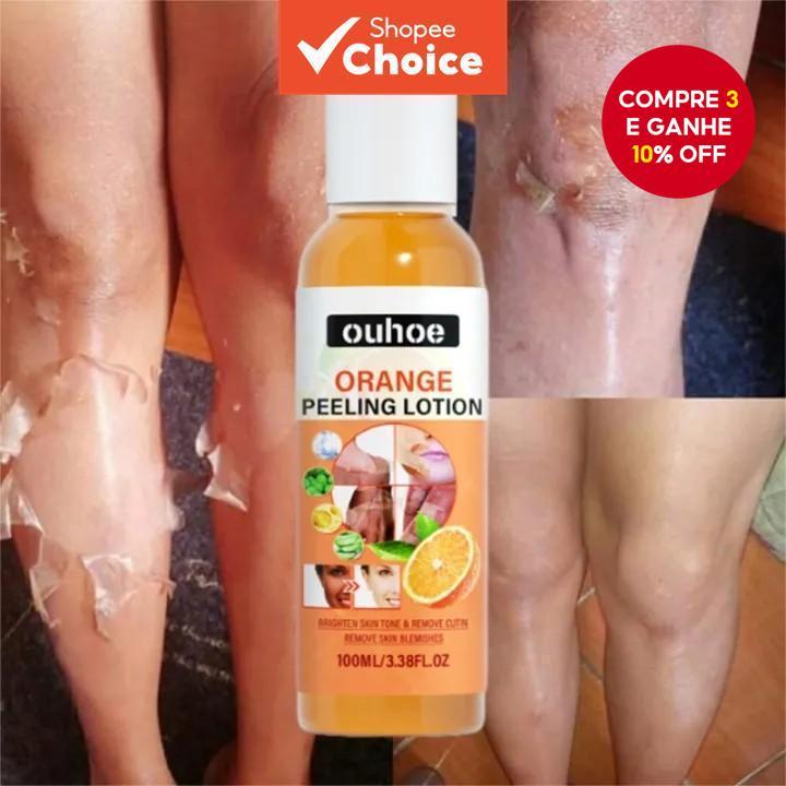 Amarelo Peeling Óleo Branqueamento Rosto Corpo Pele Escura Iluminar Loção Clarear Mão Pé Morta Casca Esfoliar Nutrir Nov
