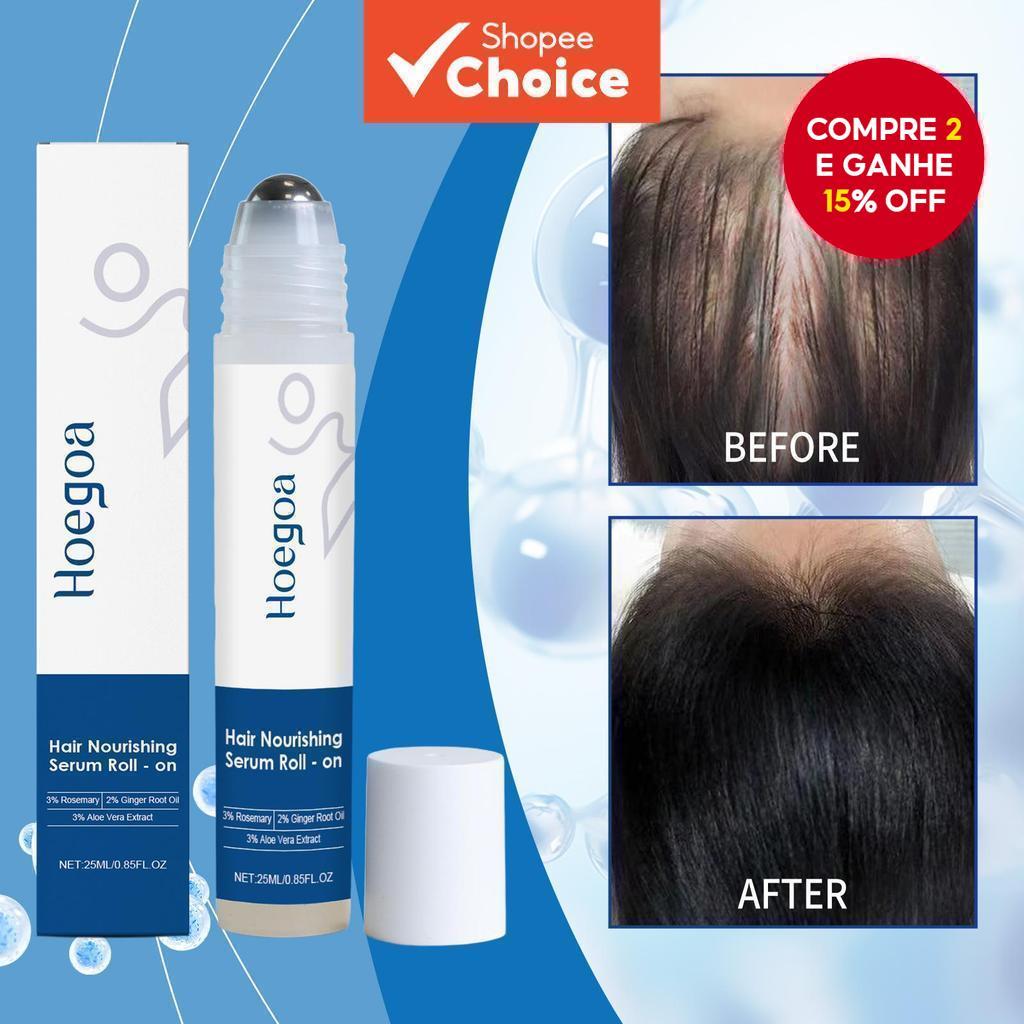 Sérum para Crescimento de Cabelo à Base de Alecrim, Sérum Capilar Roll-On, Sérum Capilar Bloqueador que Promove Fluxo