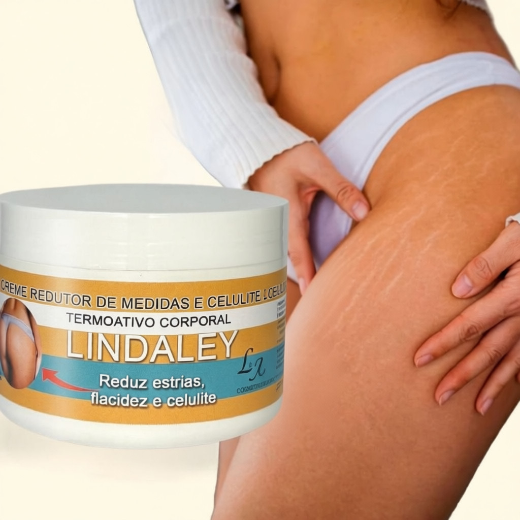 Creme Anti Estrias Lindaley 300g | Hidratação Profunda e Cuidado da Pele