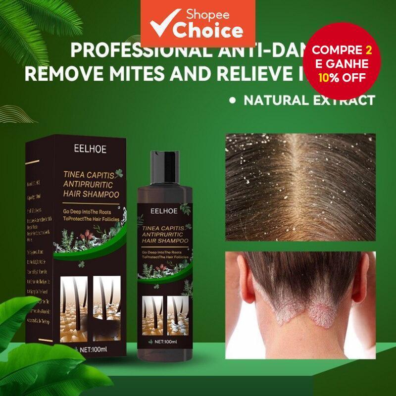 O que é Condicionador para Caspa? Guia e Onde Comprar | BuscaProdutos