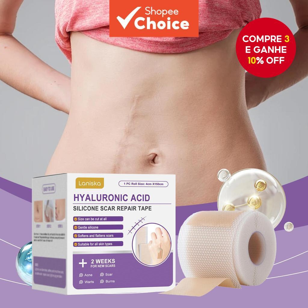 Fita Para Cicatriz De Silicone Seleane 4cmx150cm-Microagulha Natural Todos Os Tipos De Pele em Oferta na Shopee