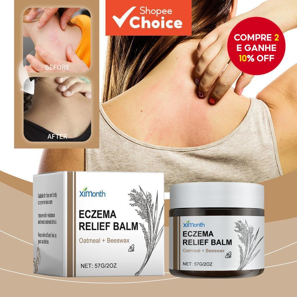 Creme para Coceira na Pele: Onde Comprar | BuscaProdutos