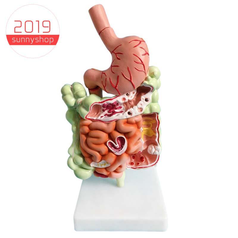 [Bestseller S] Modelo De Sistema Digestivo Humano Anatomia Do Estômago Intestino Grande Cecum Rectum Duodenum Estrutura 