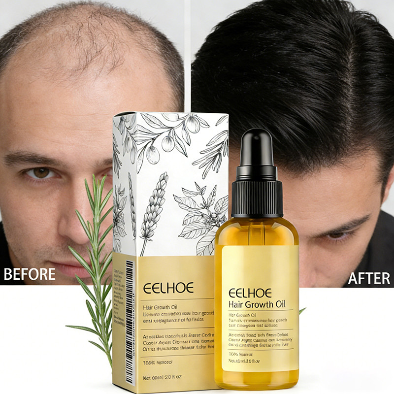 Tratamento Capilar Antiqueda Masculino: Onde Comprar | BuscaProdutos