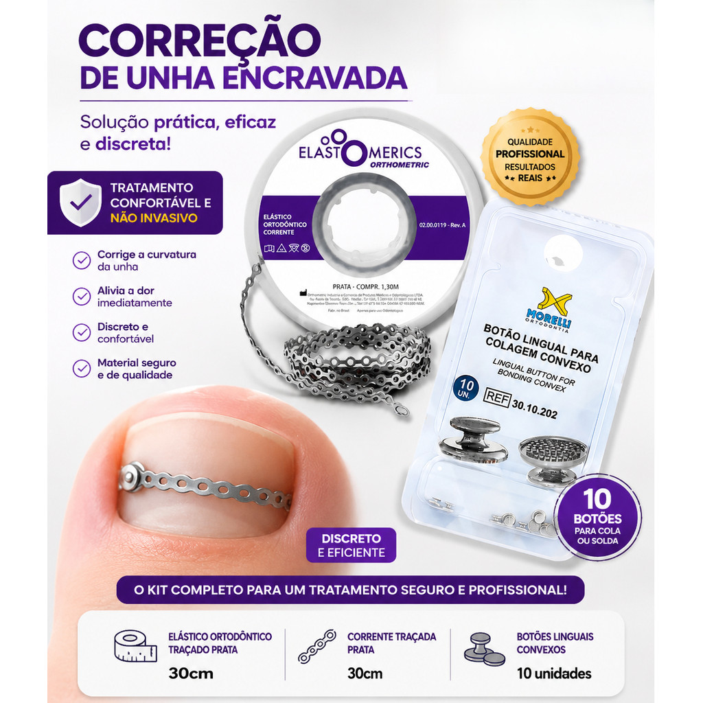 Kit Podologia Com 10 Botão Metal + Elástico Corrente 30CM -  Correção Unha Encravada  FAÇA EM CASA