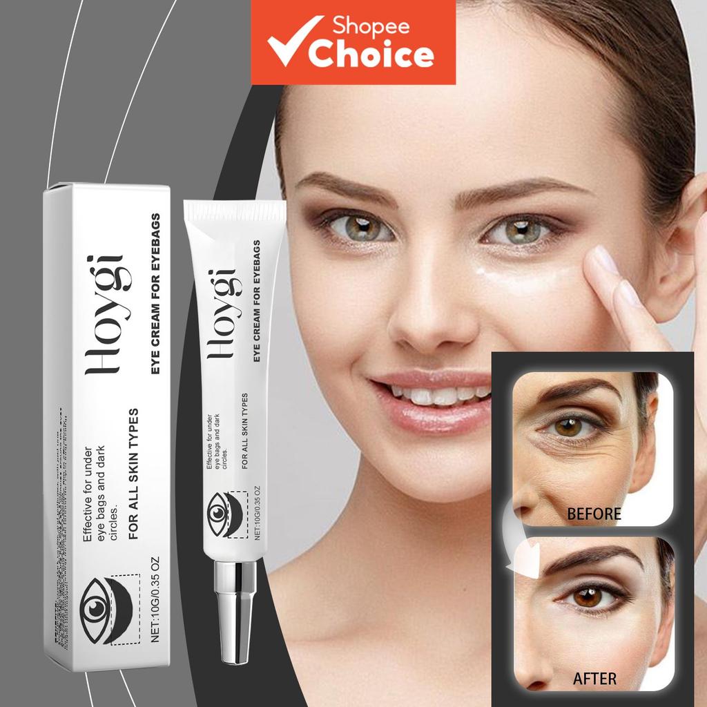 Hoygi Creme para Olhos Corretor de Olheiras e Inchaço, Tratamento Redutor de Bolsas sob os Olhos, Creme para Olhos
