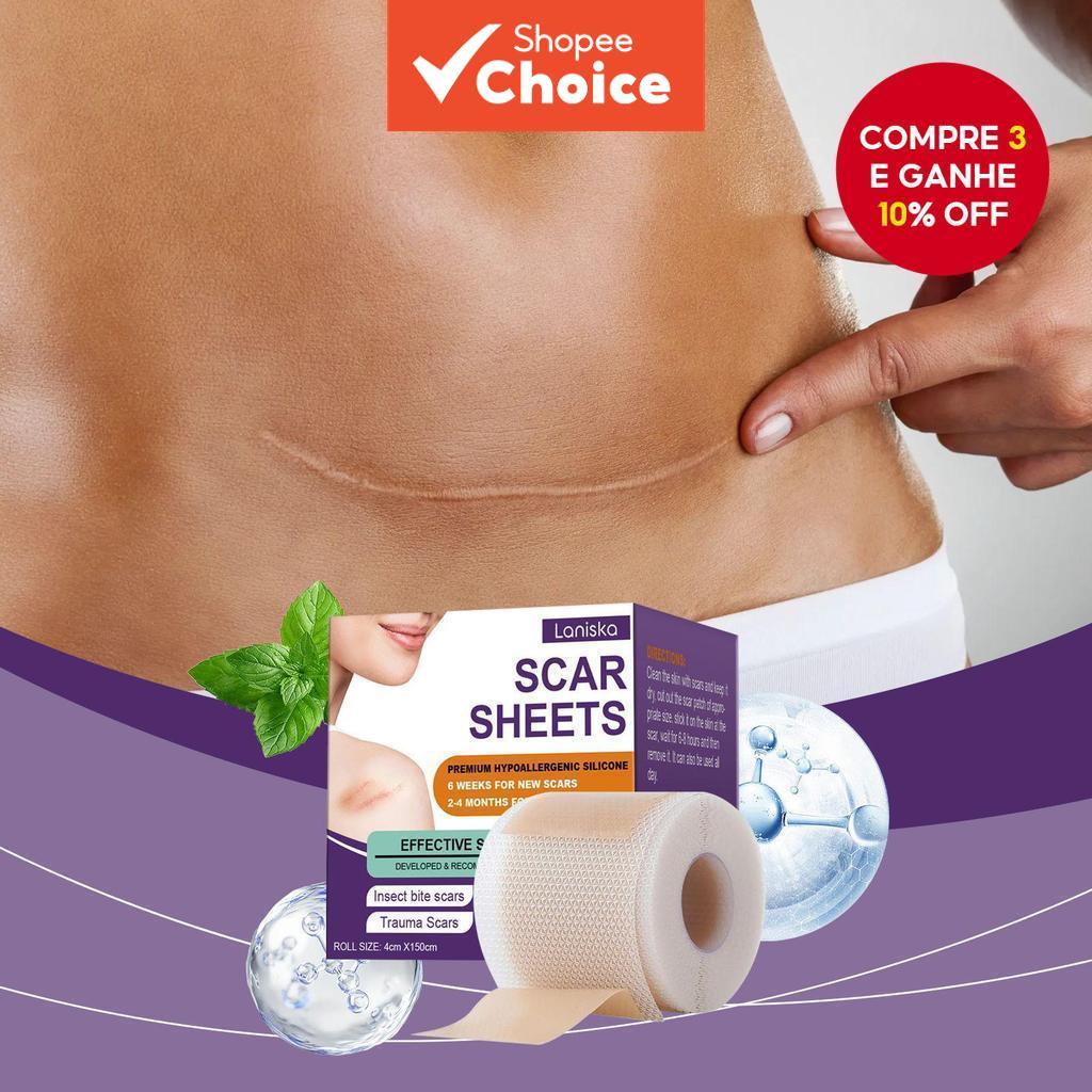 4*150cm Folhas de Cicatriz de Silicone, Fita de Cicatriz de Silicone, Fita de Cicatriz de Silicone Reutilizável para em Oferta na Shopee
