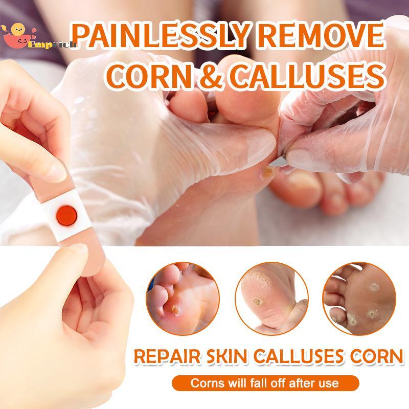 EMCH > 10/20/30/50 Pçs Malha Redonda Removedor De Milho Almofadas Pé-Callus Gesso Com Furo Remendos Sapato Produtos De C