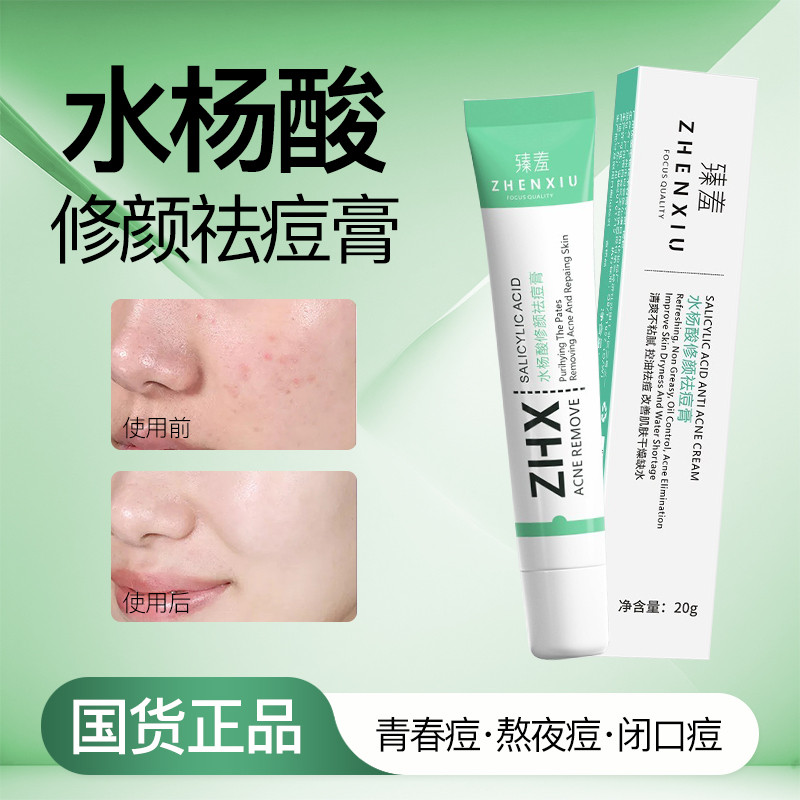 [Recomendação genuína do produto] Creme reparador de acne com ácido salicílico para reduzir marcas de acne, remover crav