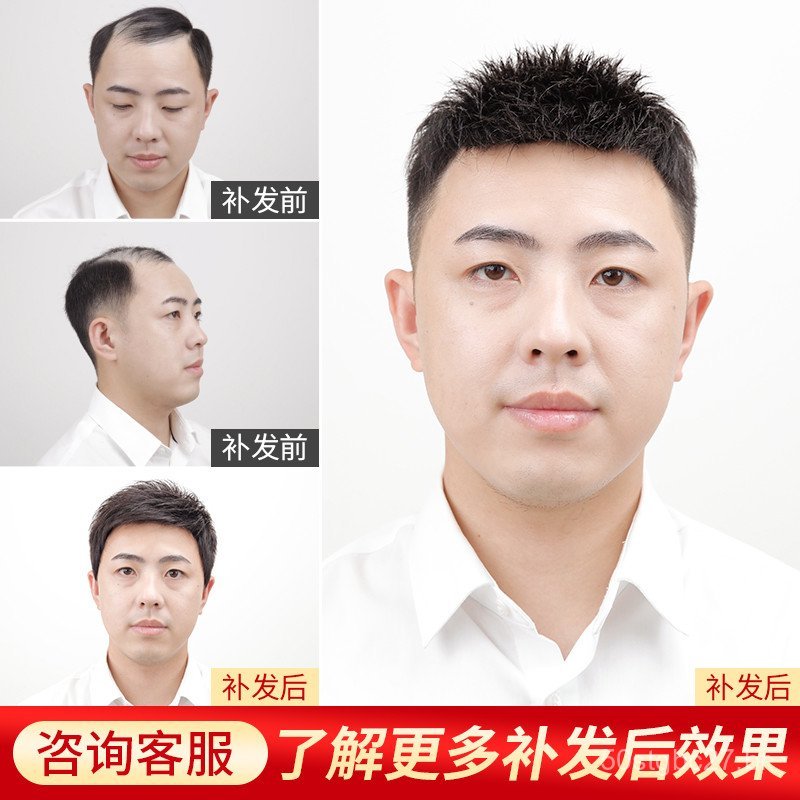 Peruca Invisível para Calvície Masculina Han Yi Jia, Peruca Ultra-Fina Sem Costura com Cabelo Humano Real.