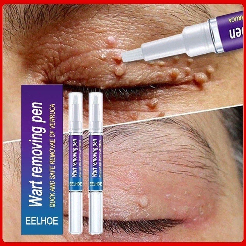 O Novo Creme Eliminador granular Repara Profundamente A Pele