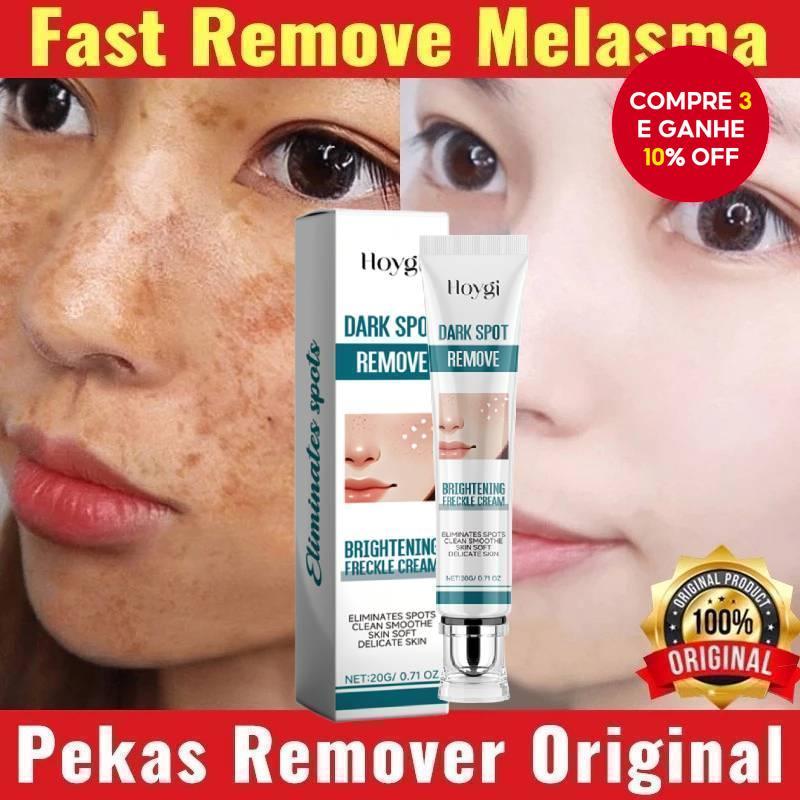 Creme Clareador para Melasma no Rosto: Onde Comprar | BuscaProdutos