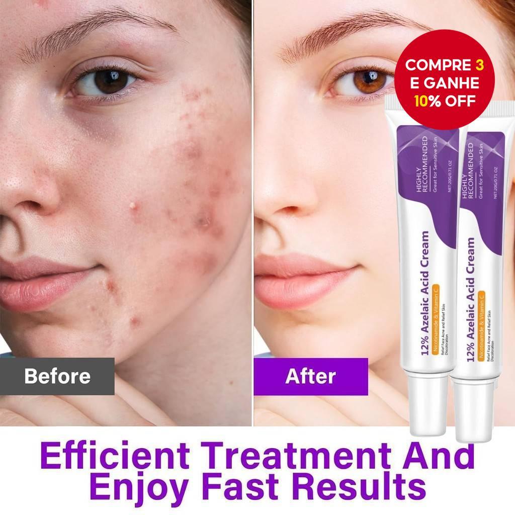 O que é Produtos com Niacinamida? Guia e Onde Comprar | BuscaProdutos