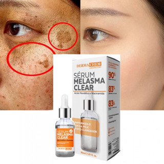 Sérum Clareador de Melasma Uniformiza o tom da Pele Clareia Manchas Clareador Niacinamida Dermachem em Oferta na Shopee