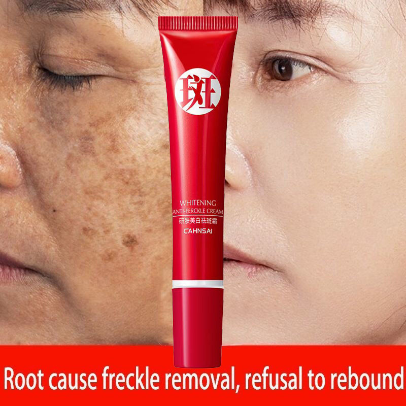 Poderoso creme exclusivo para remoção de sardas, Remove manchas escuras/coloração calmante/cuidados com a pele B8V3