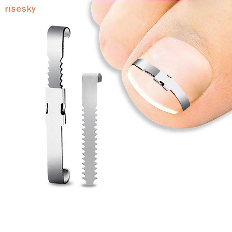[risesky] Ferramentas Corretoras De Unhas Encravadas Pedicure Recuperar Incorporar Tratamento Correção Ferramenta De Cui