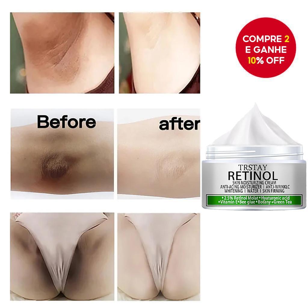 Creme Clareador para Pele Negra: Onde Comprar | BuscaProdutos