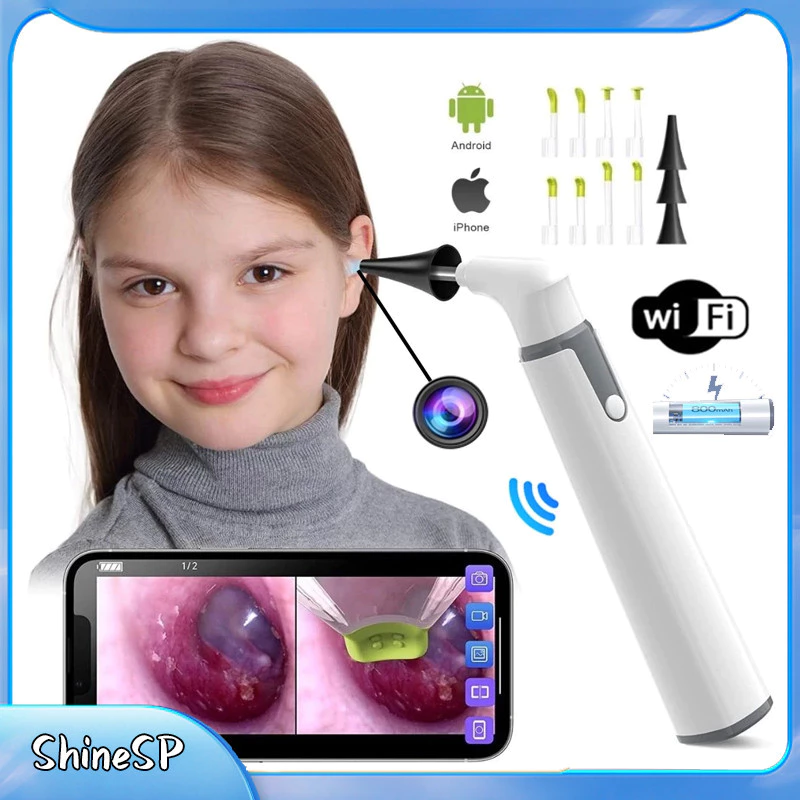 Otoscópio Digital Wifi S/ Fio Mini Câmera Recarrega Médico