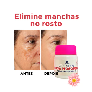 Creme Clareador Rosa Mosqueta com Niacinamida | Manchas no Rosto Antirrugas Melasma