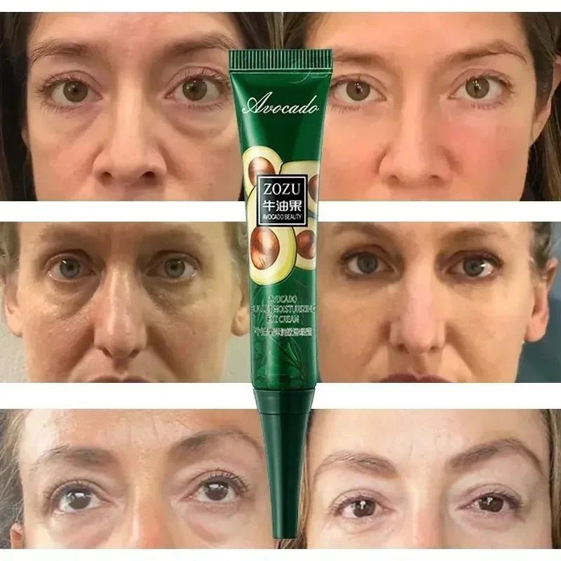 Remoção Instantânea De Rugas Creme De Olhos Anti-Sacos De Círculos Escuros Puffiness Fade Eye Fine Line Apertar Sob Os