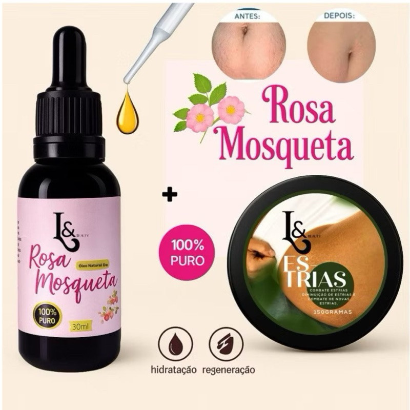 Kit Creme Redutor De   Estrias + Óleo Rosa Mosqueta 100% 30ML - L&Beauty