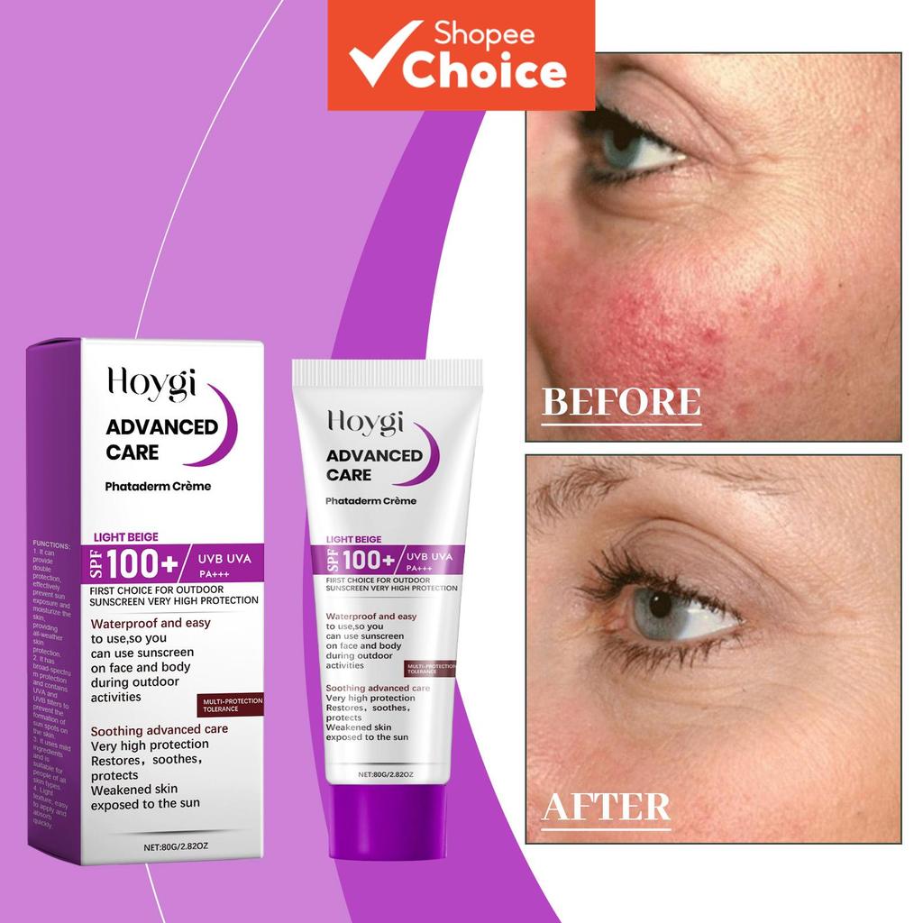 Protetor Solar para o Rosto Pele Oleosa: Onde Comprar | BuscaProdutos