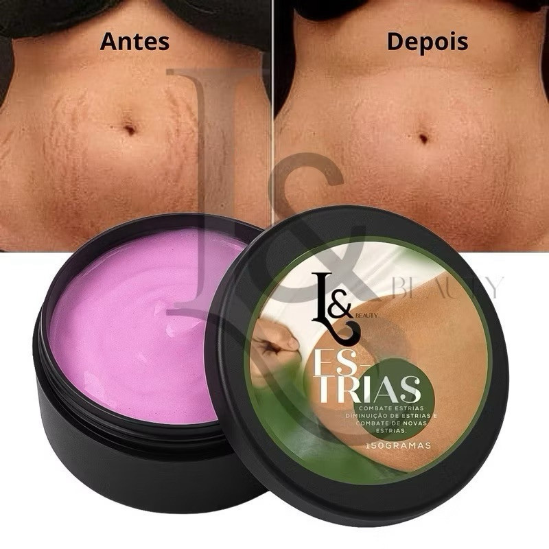 Creme reduz Estrias  Anti Estrias Trata E Previne 150g - L&Beauty em Oferta na Shopee