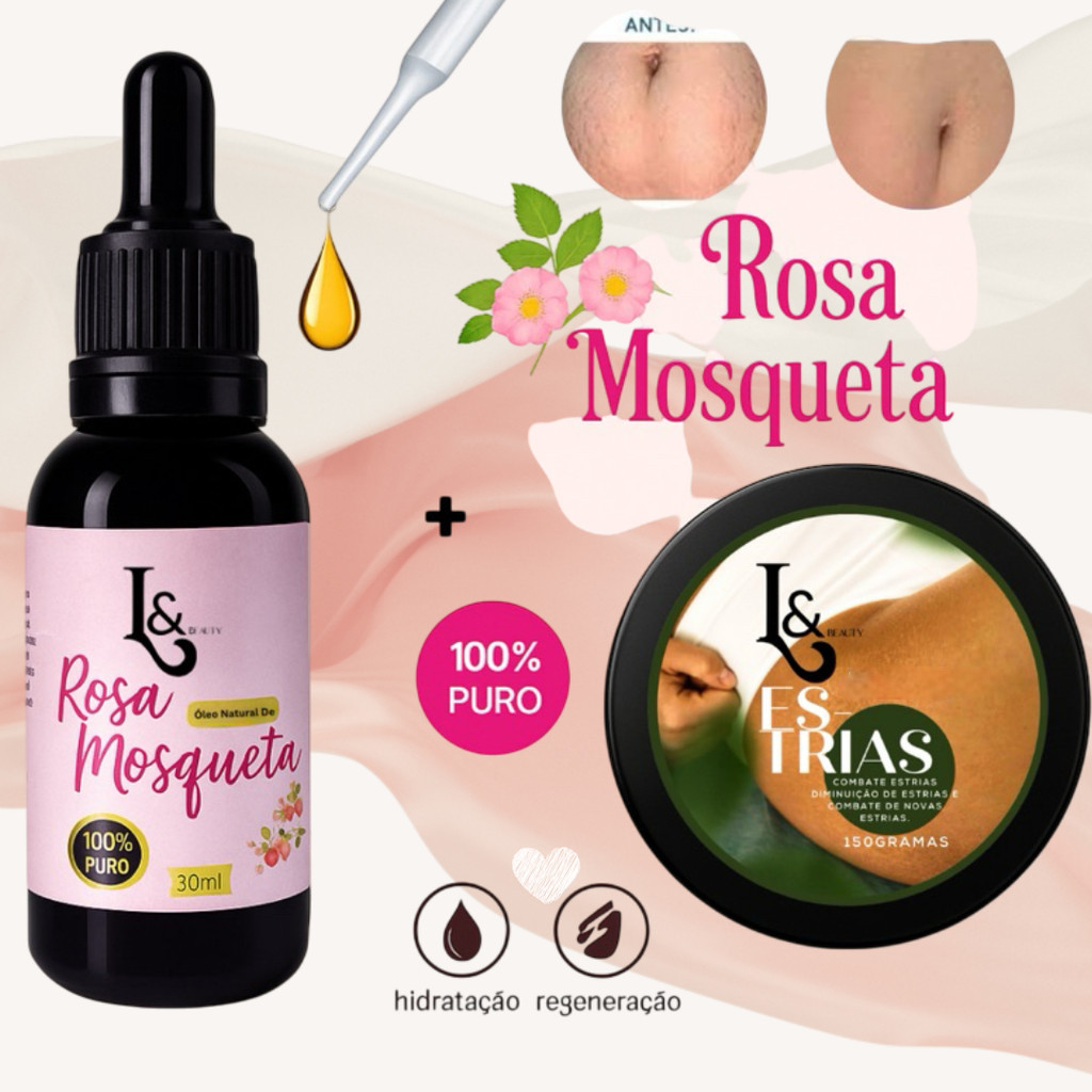 Kit Rosa Mosqueta Puro + Creme Corporal para Estrias + Pipeta – L&Beauty