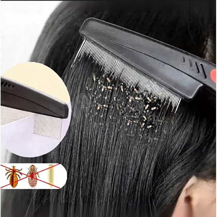 Pente Para Piolhos , Ovo De Cabelo , Aço Inoxidável , Escova Anticaspa , Não Danifica O Couro Cabeludo