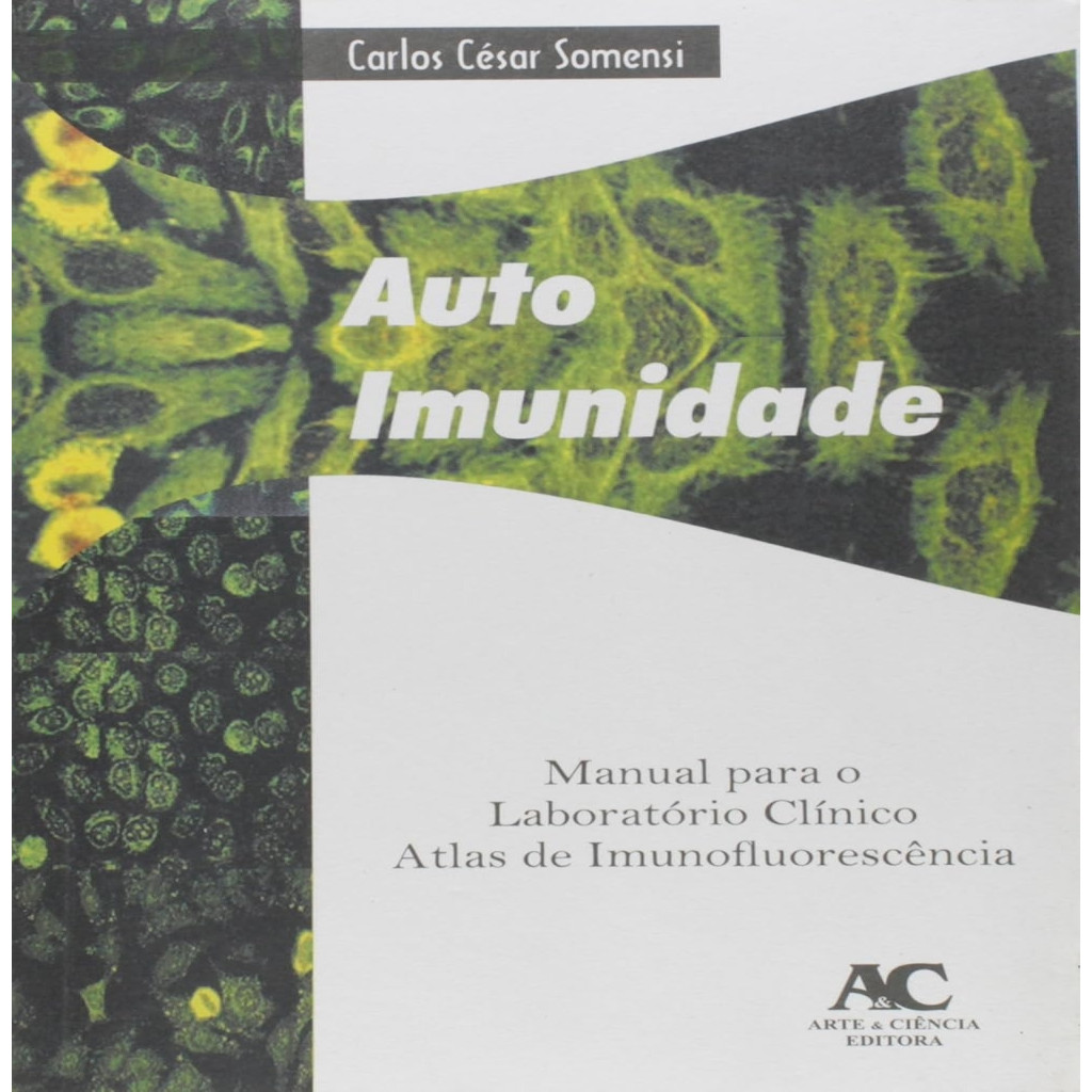 Auto Imunidade - Manual Para O Laboratorio Clinico autor Somensi, Carlos César
