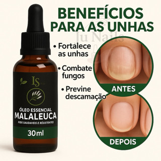 Óleo Vegetal Melaleuca Tea Tree 100% Puro 30ml Para Unha Pele Cabelo L&Beauty em Oferta na Shopee