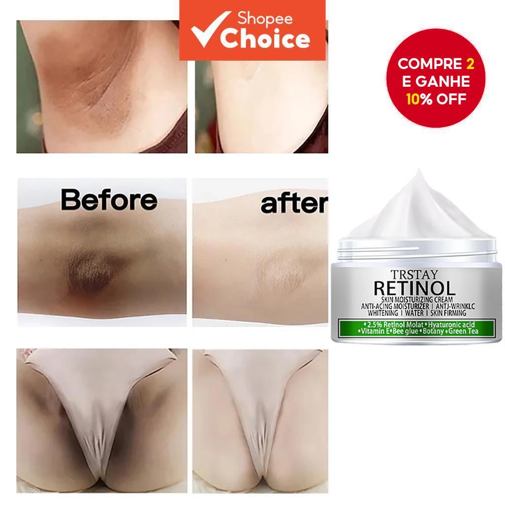 Creme Clareador Pele Negra: Onde Comprar | BuscaProdutos