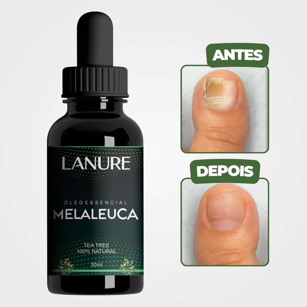 Óleo de Melaleuca para Cabelo: Onde Comprar | BuscaProdutos