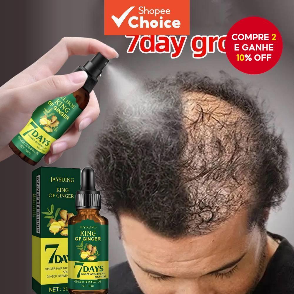 Queda de Cabelo Masculino: Onde Comprar | BuscaProdutos