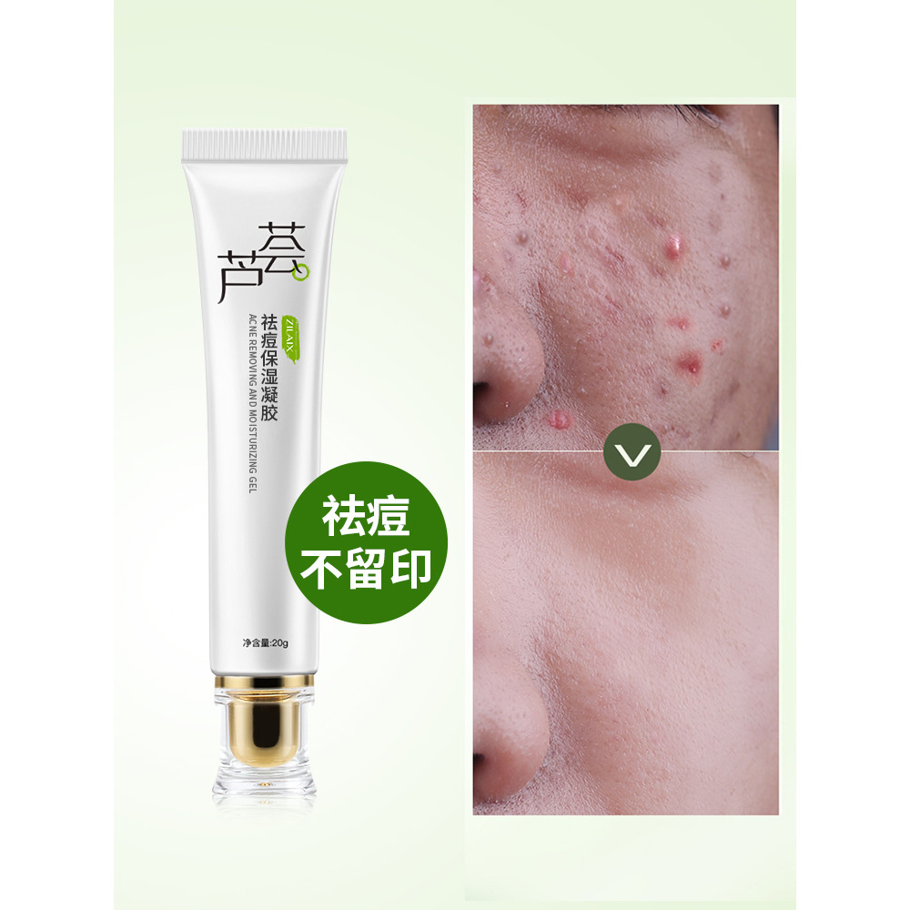 Aloe Vera gel remoção de acne reparação acne Pit Fade acne marca gel oficial carro-chefe creme de remoção de acne genuín