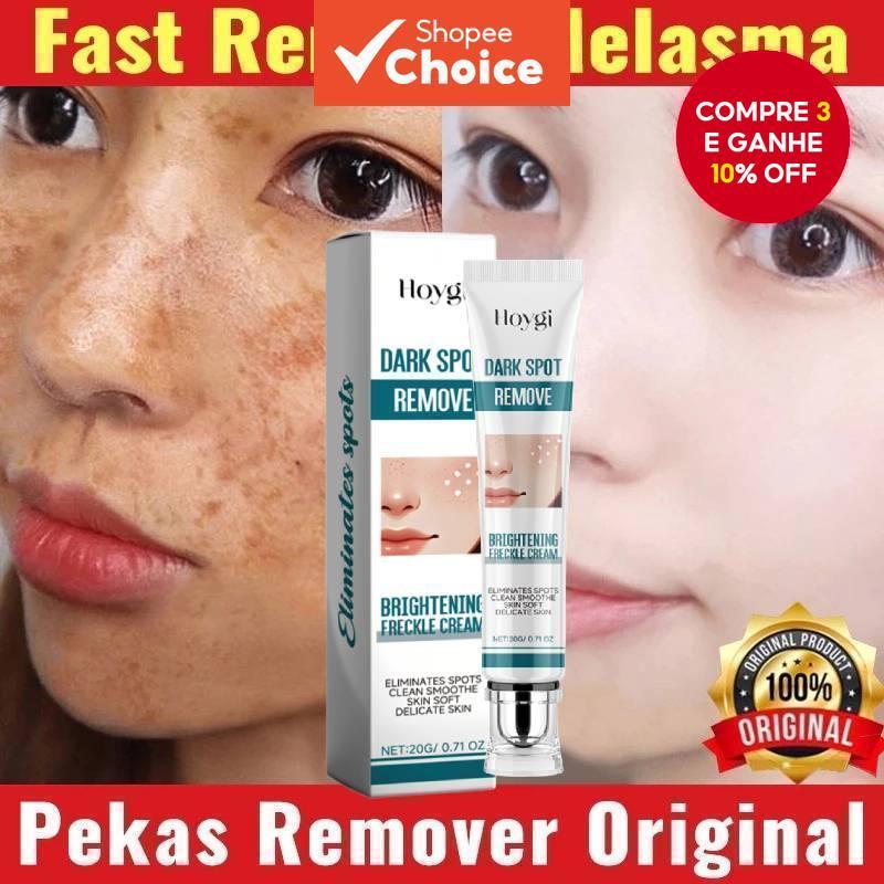 Creme Removedor de Manchas no Rosto: Onde Comprar | BuscaProdutos